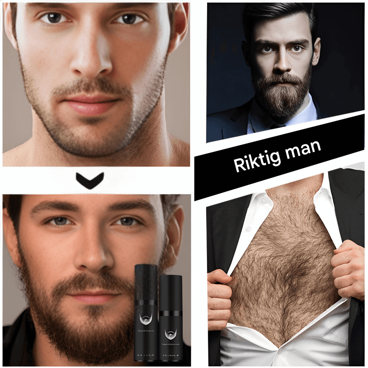 BeardForge – Skäggväxt Kit för Män med Roller, Serum, Desinfektionsspray & Kam