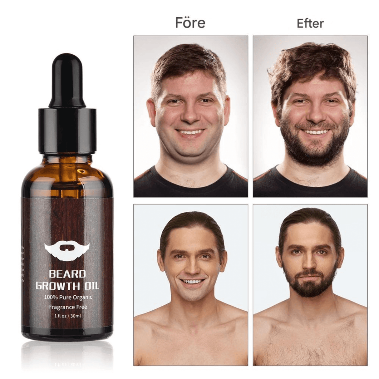 BeardPeak – Skäggvårdsset med Olja, Balm, Micro-Needle Roller & Kam för Ett Välvårdat Skägg