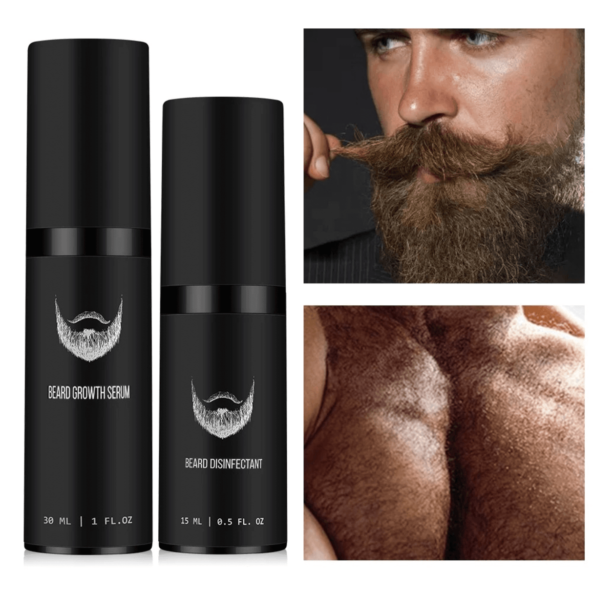 BeardForge – Skäggväxt Kit för Män med Roller, Serum, Desinfektionsspray & Kam
