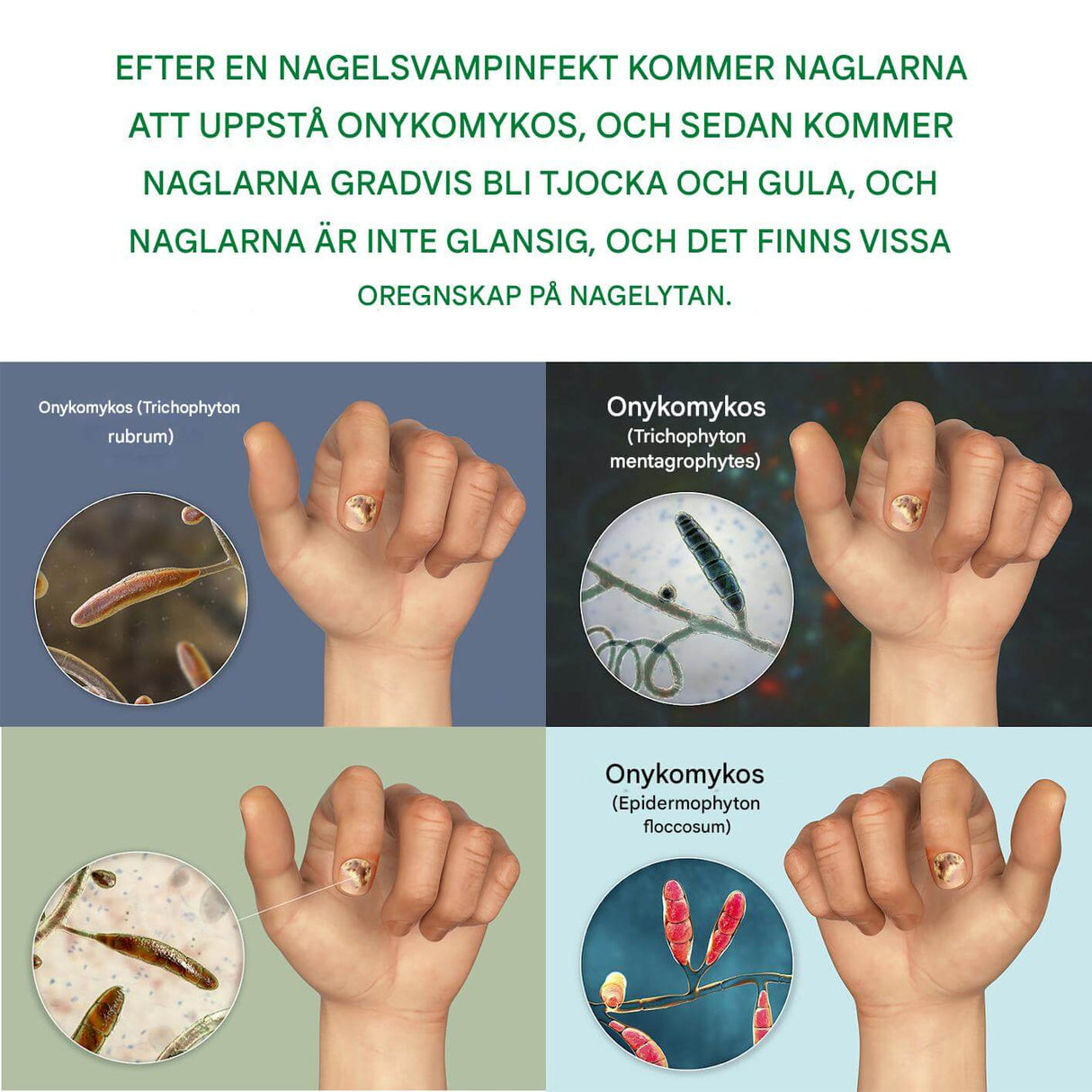 FungiClear – Nagelserum mot Svamp | Effektiv Nagelvård för Starkare Naglar