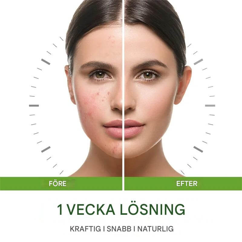 GrönRoa – Vegansk Ansiktskräm med Tea Tree | För en Lugnare, Mer Balanserad Hud