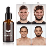 BeardPeak - Beard Care Kit with Oil, Balm, Micro-Needle Roller & Comb for a Well Groomed Beard