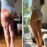 GlowCup - Cellulite Remover and Skin Tightening with Red Light and Cupping Therapy