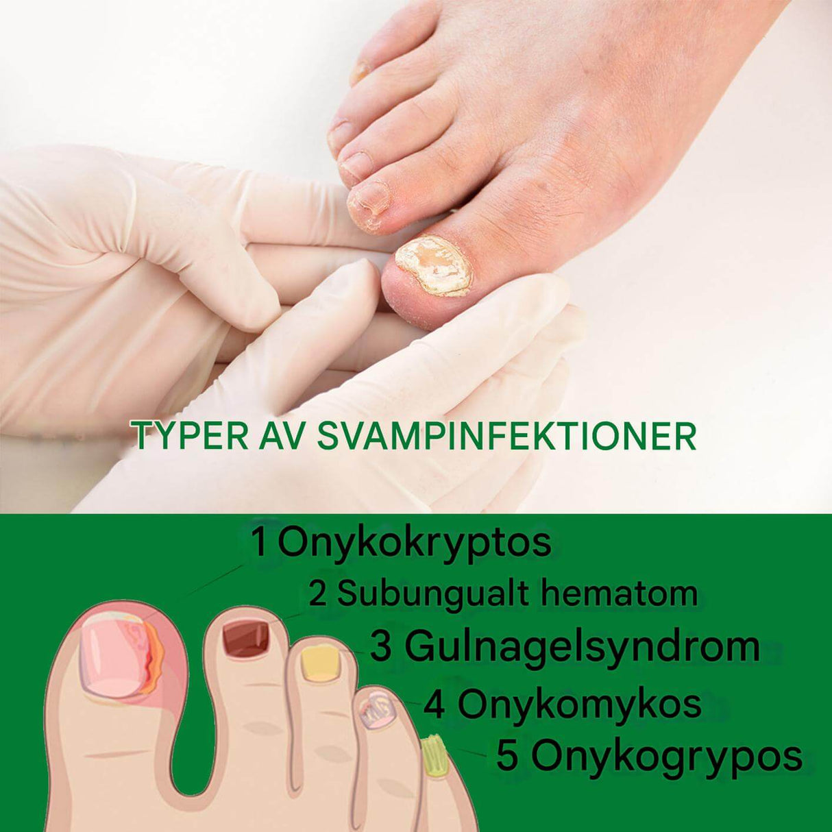 FungiClear – Nagelserum mot Svamp | Effektiv Nagelvård för Starkare Naglar