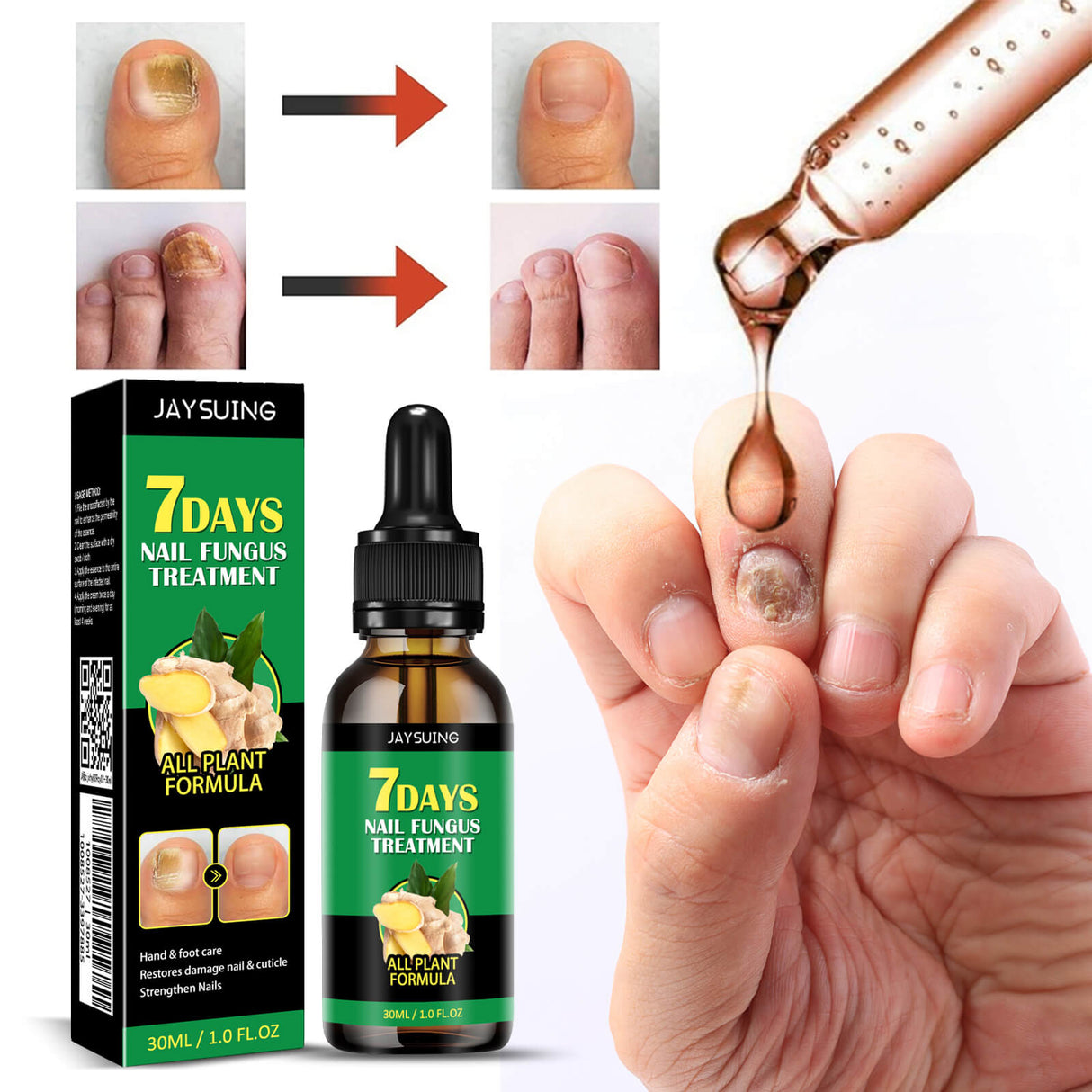 FungiClear – Nagelserum mot Svamp | Effektiv Nagelvård för Starkare Naglar
