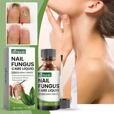 OnyFix - Nail Fungus Treatment & Restoration of Nail Health